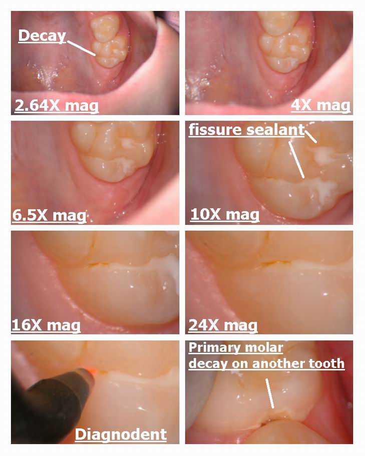 Resize of Various mags of decay.jpg